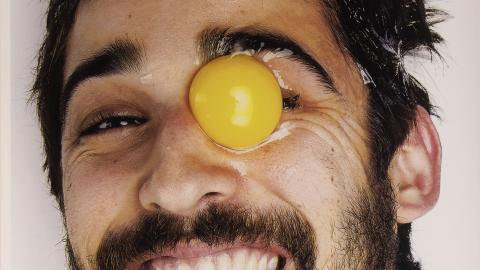 Photograph of smiling man with a raw egg in his eye socket.